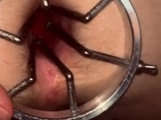 Ass stretching with dilator