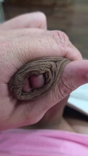 The Head of My Penis