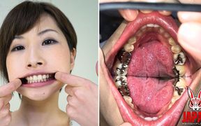 Teeth Inspection Chronicles: Dive Into Yua Hidaka's Enigmatic Oral Realm