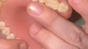 I GOT A NEW FULL SET OF DENTURES watch and listen