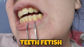 Yellow Crooked Teeth Exploration and Dry Brushing – Up Close Oral Fetish with Dirty Smile and No Toothpaste