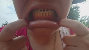 Opening her mouth to show her teeth