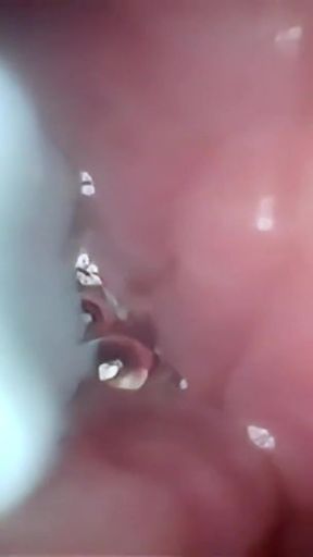 Semen in Cervix Wide Stretching Pussy Endoscope!   Clip 2