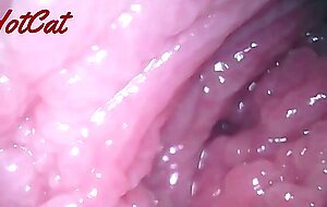 Endoscopic heartsvaginal observation
