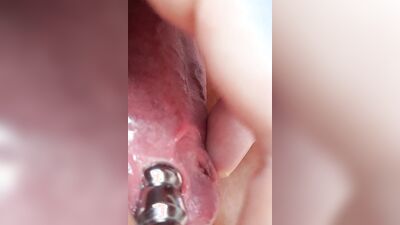 Sounding with a close up cum load through penis plug