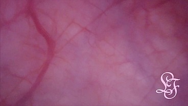 Fucked in my Pussy + Camera in my Bladder = Crazy Bulge!
