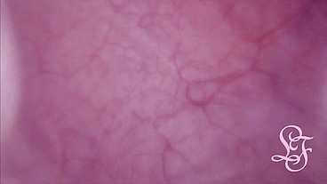 Fucked in my Pussy + Camera in my Bladder = Crazy Bulge!