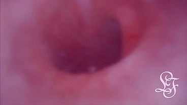 Fucked in my Pussy + Camera in my Bladder = Crazy Bulge!