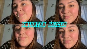 Streams of snot