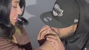 Mordedura de mano y dedos