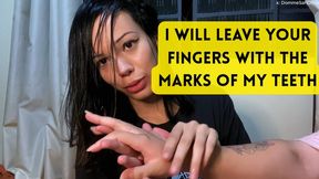 Biting my friend's hands and fingers repeatedly after losing at rock-paper-scissors