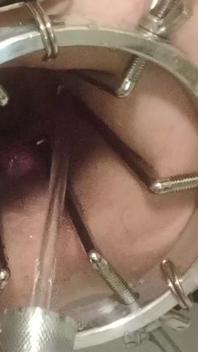 Enema, anal shower. Close-up view through anal mirror. Anal with water. Filling anal with water   Clip 1