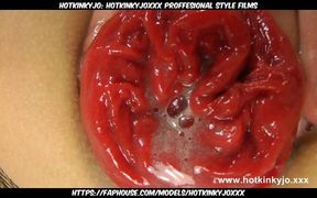Hotkinkyjo's Extreme Anal Prolapse Session