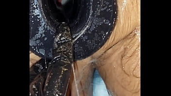 Расширитель ануса