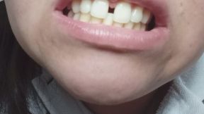 Admire my imperfect teeth - fetish