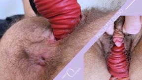 Anal Prolapse Dildo Fucks Hairy Ftm Pussy
