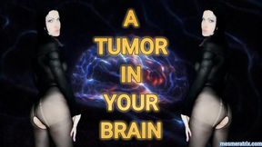 A TUMOR IN YOUR BRAIN