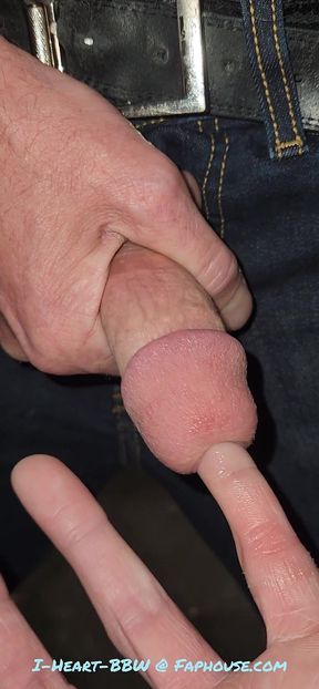 Gaping Urethra - Marker and Pinky Insertion