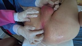 Two Nurses Scrutinised My Dick And Licks Ass In The Hospital