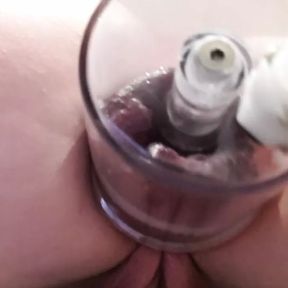 Julie&#039;s new anal vacuum box