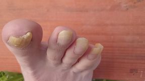 Gnarlie Harper Toenail Growth Update - 6 Months No Cut - My US 11 Bad Yellow Nails Thick & Gnarly