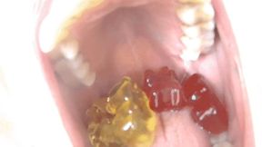 Gummy bears inside my mouth