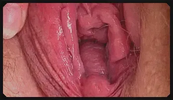 Hairy Mature BBW Fingering