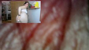 Stinky farts with medical endoscope