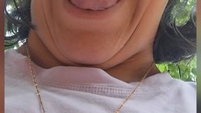 uvula of a trio