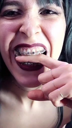 Biting My Fingers - Bite, Mouth, Teeth, Braces, Fetish Ita