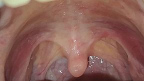 My uvula for you.