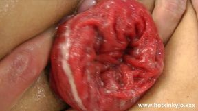 Hotkinkyjo's extreme anal fisting leads to anal prolapse
