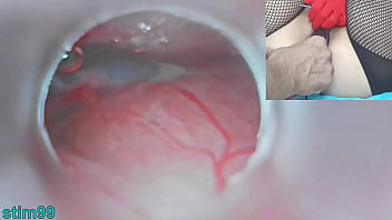 Dr  Japanese Gyno creampies Asian womb live on cam
