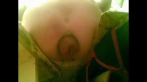 A Young Guy Is Sitting on a Chair with Anal Prolapse