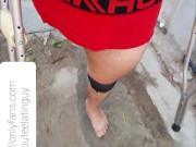 Amputee guy walking with crutches