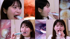 Maina Yuuri - Observing Maina's teeth, mouth, and back of the throat with a dental camera