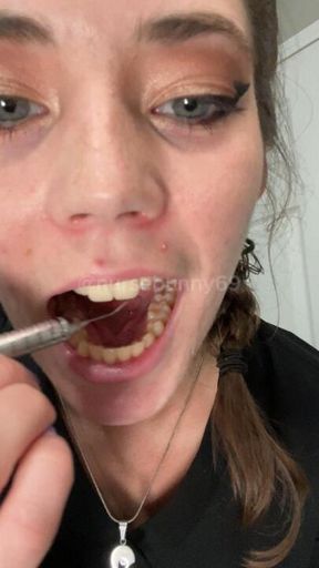 Sadistic Dental Cleaning with Explorer and Cavity Fillings