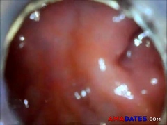 anal endoscope ass play from inside