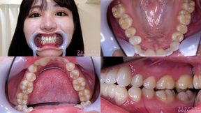 Hikage Hinata - Watching Inside mouth of Japanese cute girl - MOV 1080p