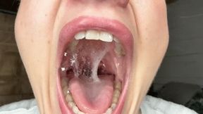 Bubbling phlegm, angina, swollen tonsils HD