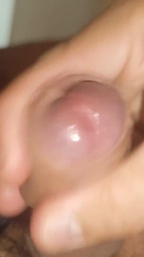 Maximum Dilation of Phimosis Cumming.